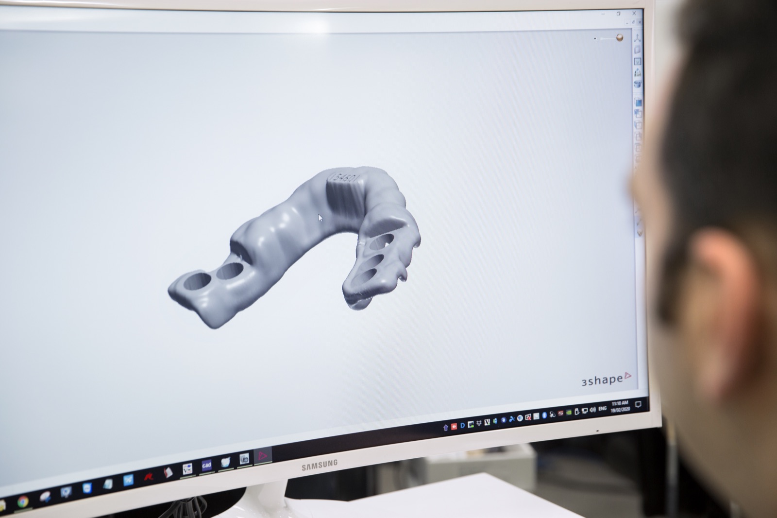 A surgical guide being designed on screen in 3D implant planning software