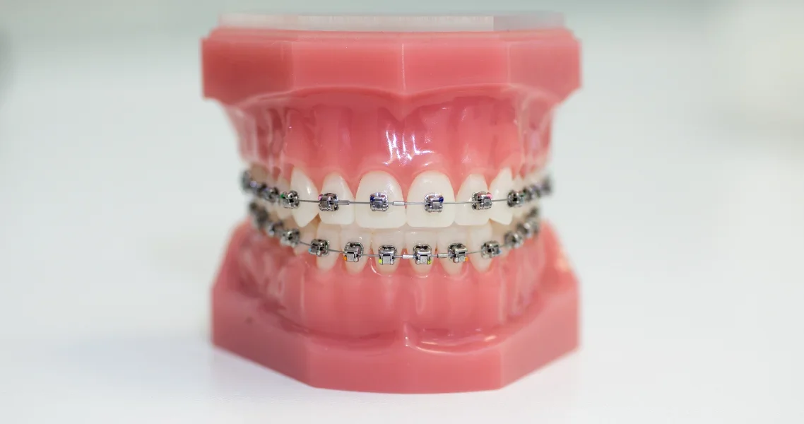 Orthodontic treatment for all ages