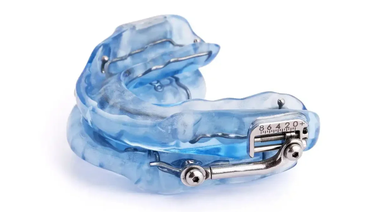 Sleep apnea treatment with custom oral appliance