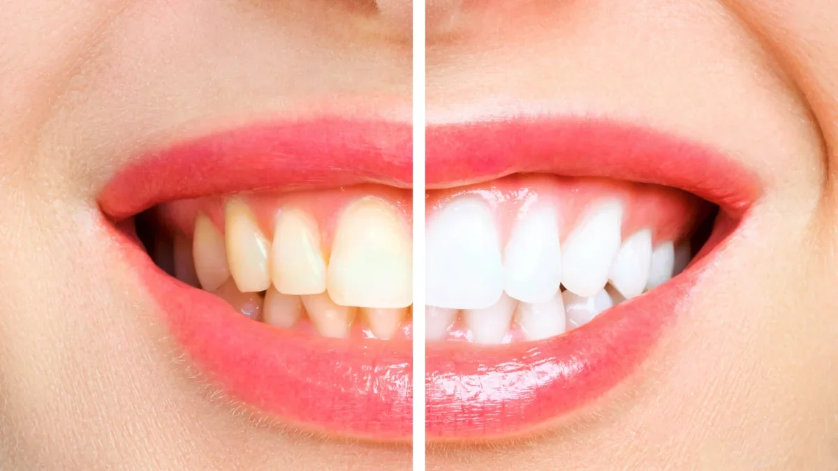 Children's dental checkup