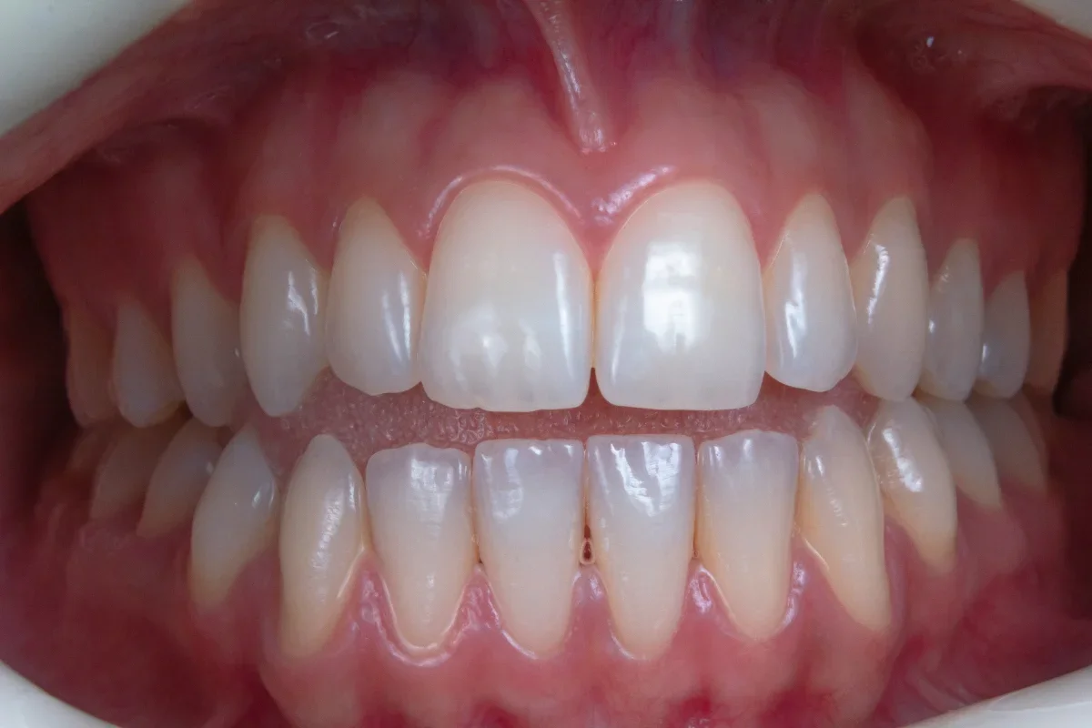 Young adult dental care