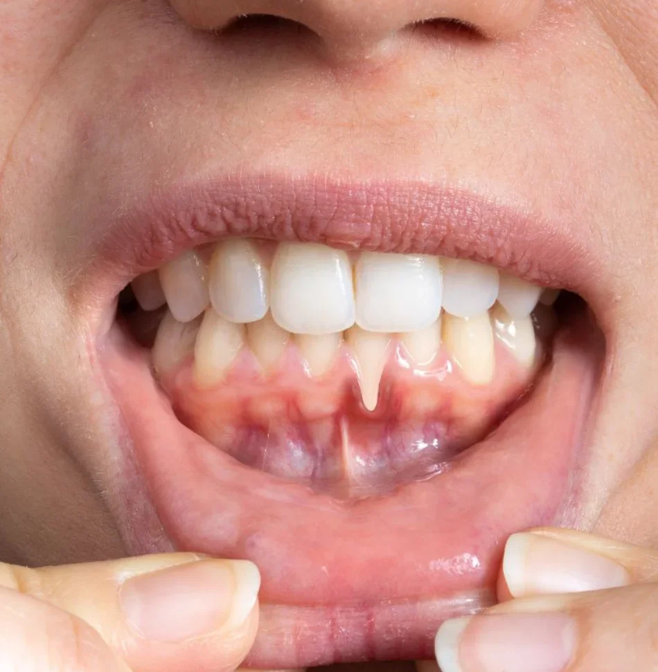 Patient with gum concerns