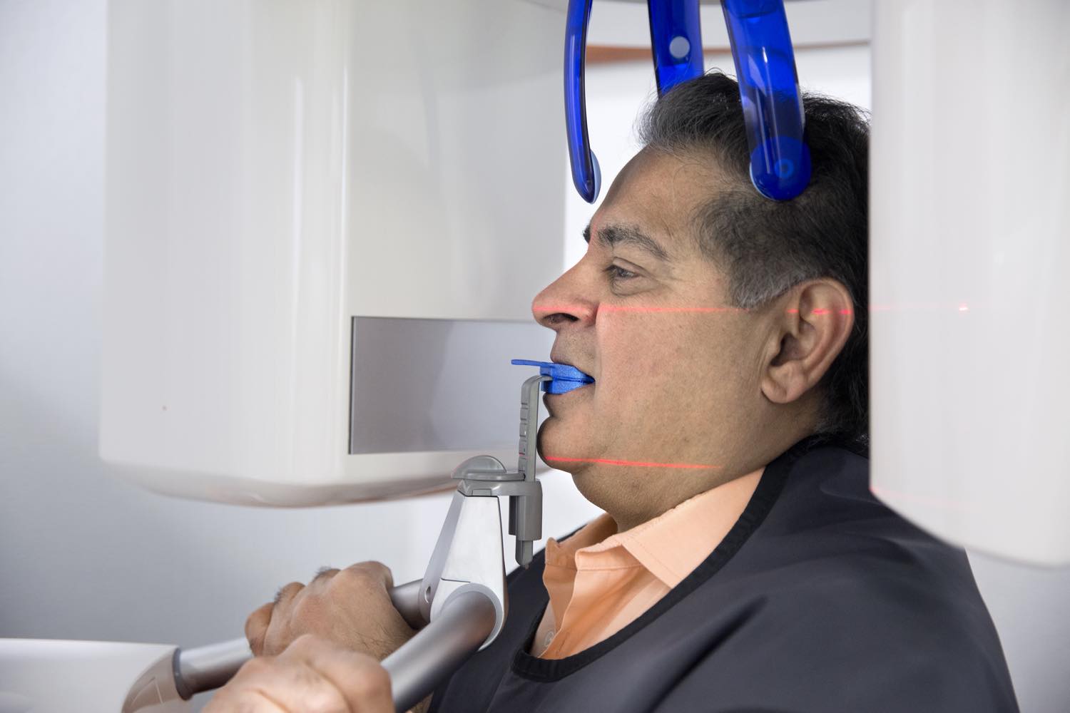 A 3D CBCT scan used to assess jawbone before implant planning