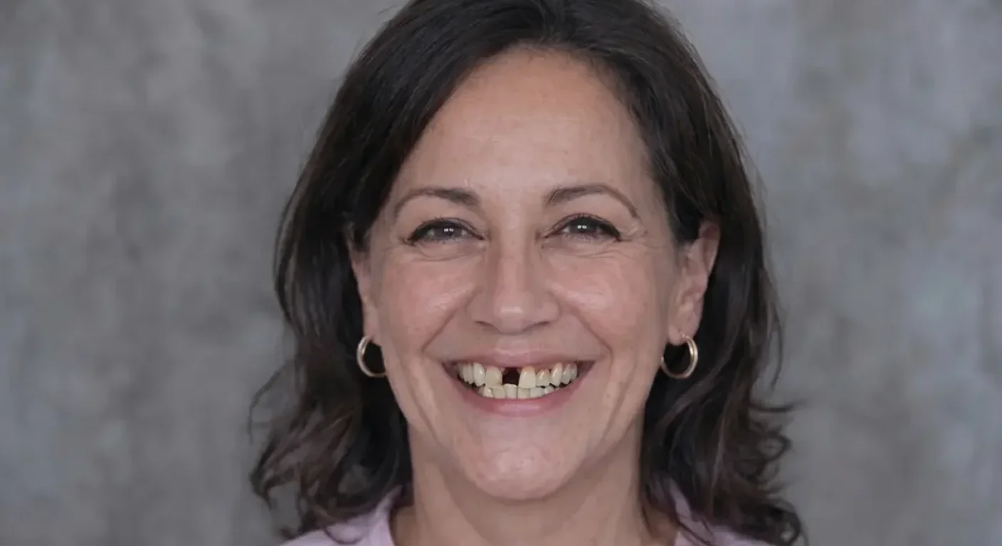 Before single tooth implant