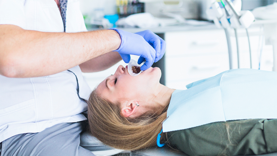 Full Mouth All-On-6 Dental Implants – Case of the week.