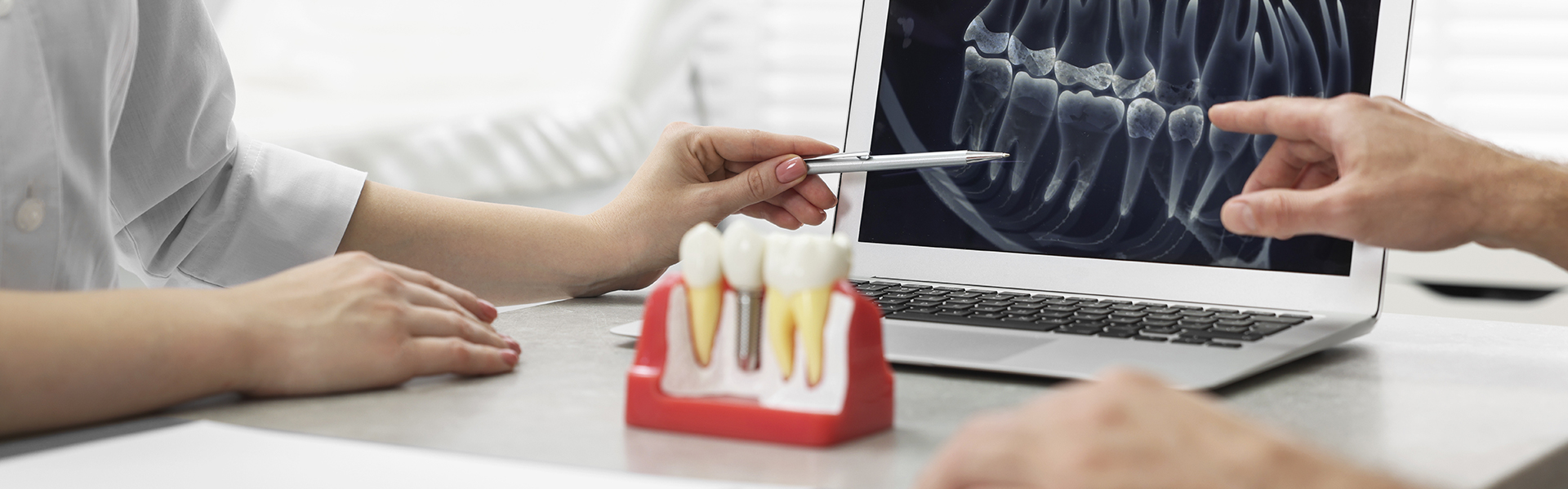 Case of the week- Transforming Smiles with Vitality Dentistry’s Computer Guided Dental Implant Solutions
